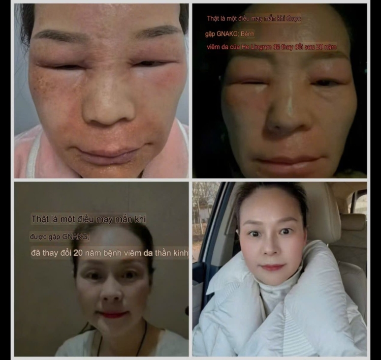 Viên chống lão hóa GnAKG