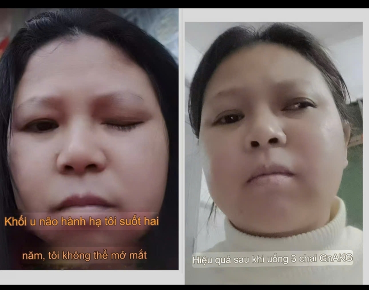 Viên chống lão hóa GnAKG