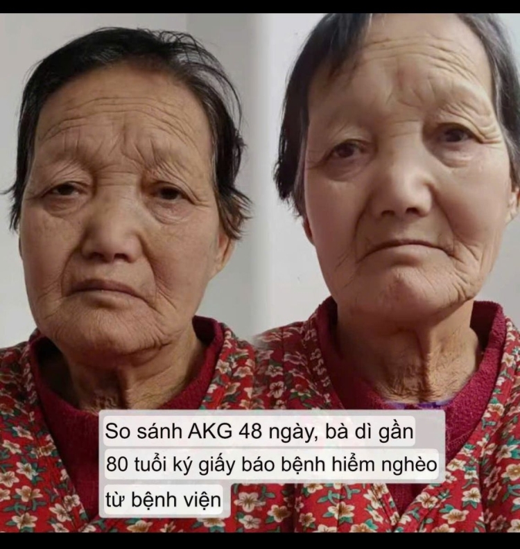 Viên chống lão hóa GnAKG