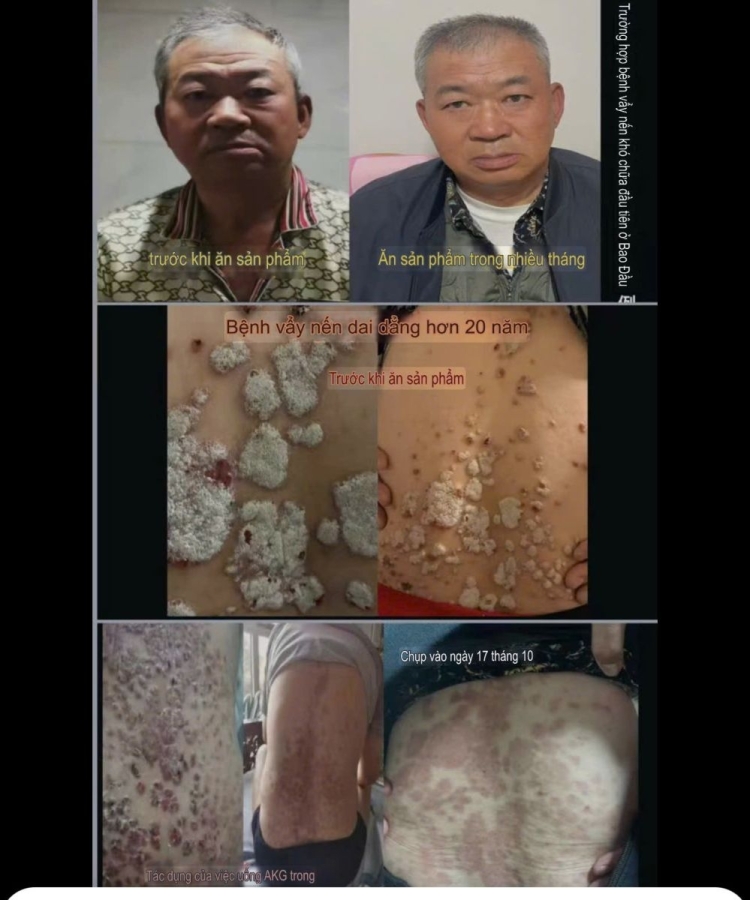 Viên chống lão hóa GnAKG